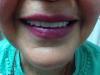Foto de Problemas dentales?